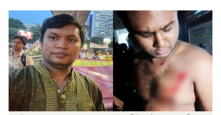 ডাকসুর ভিপি প্রার্থী জালালের বিরুদ্ধে রুমমেটকে ছুরিকাঘাতের অভিযোগ