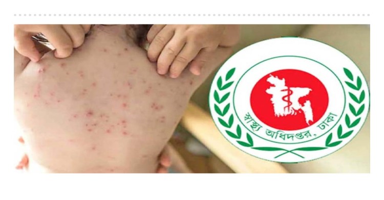 হাম ও উপসর্গ নিয়ে আরও ৬ জনের মৃত্যু